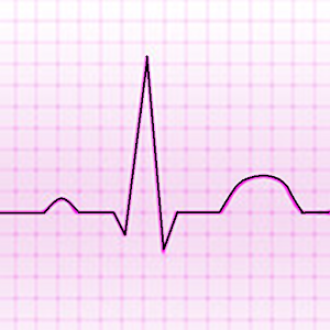 Скачать приложение Electrocardiograma ECG Tipos полная версия на андроид бесплатно
